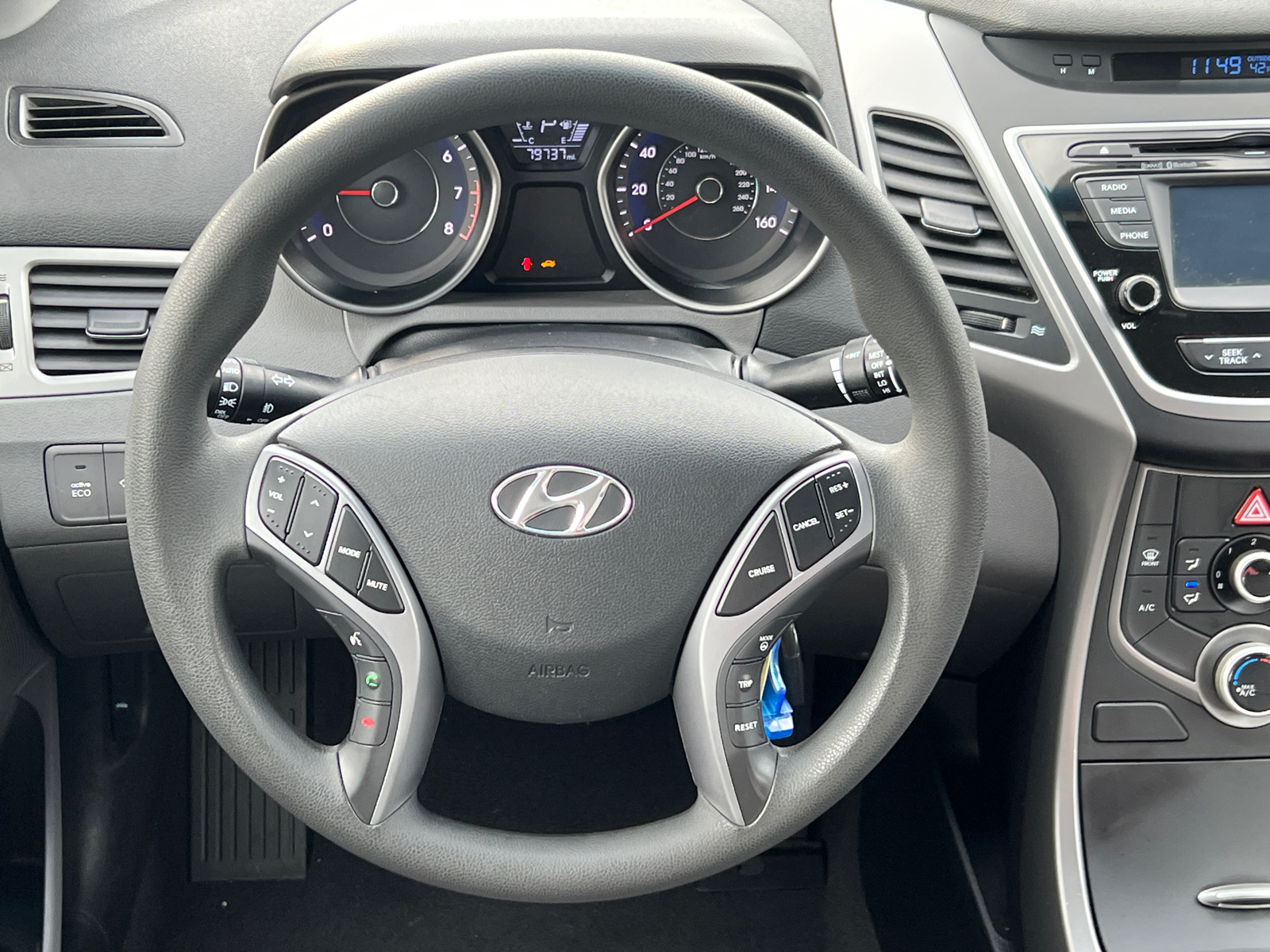 2015 Hyundai Elantra SE 25