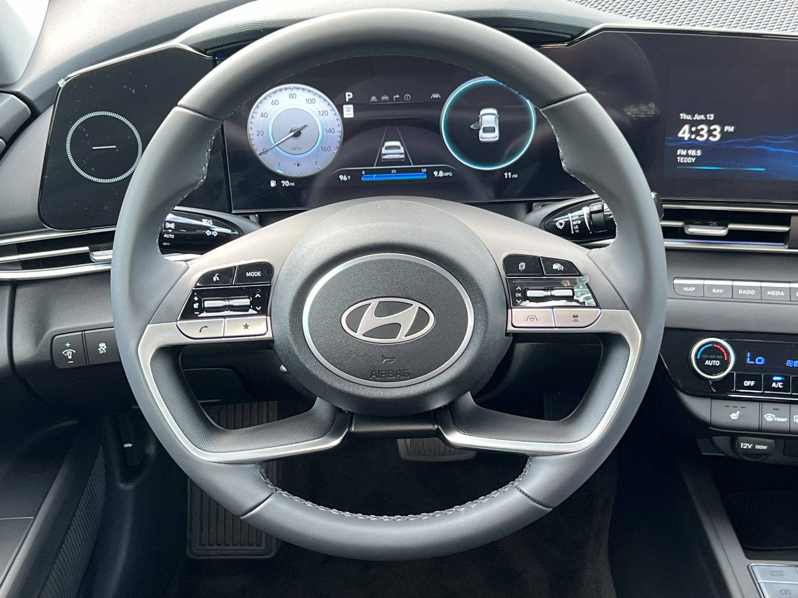 2024 Hyundai Elantra SEL 15